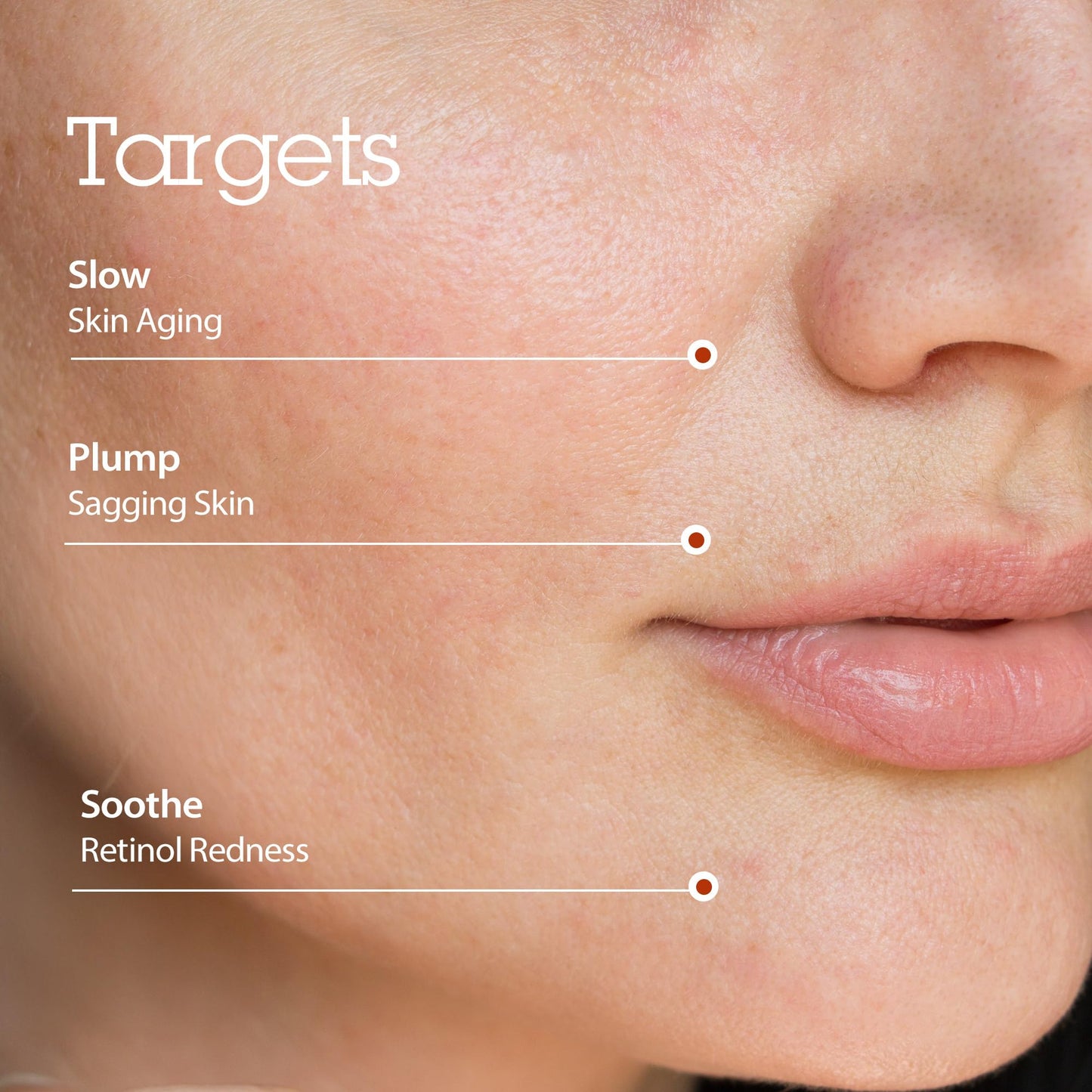 BLITHE Targeted Tightening Retinol 0.1 Serum, Wrinkle and Firm Concentrated Care, Formulated with Pure Retinol 0.1%, 1.0 fl oz