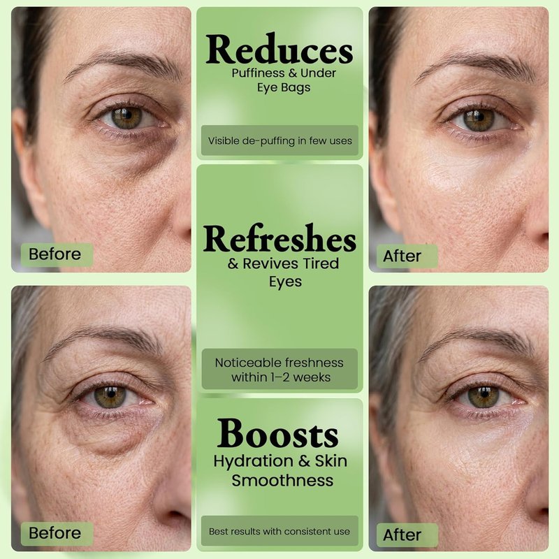 Anti-Puffiness Hydrogel Undereye Masks - Collagen & Cucumber for Dark Circles | 6 Pairs
