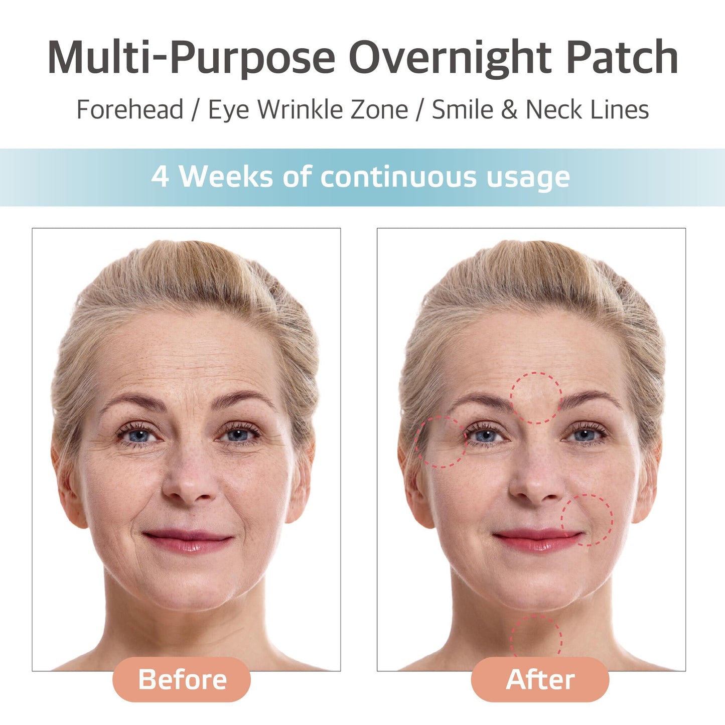 Wooshin Labottach Smile Line Patches for Face – 8ct Korean Skincare Hydrogel Firming Patch for Between Eyes, Under Eyes & Fine Lines with Adenosine, Tartaric Acid Stretch & Lift Home Skin Care