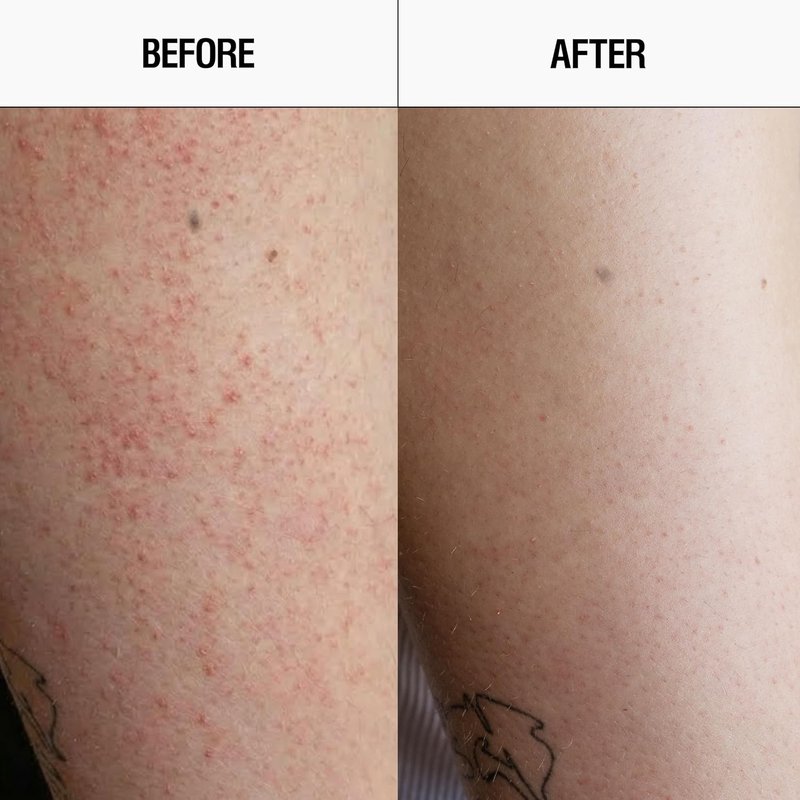 Grown Alchemist Resurfacing Body Cleanser - Acne Exfoliating Wash with Salicylic & Glycolic Acids | 300mL