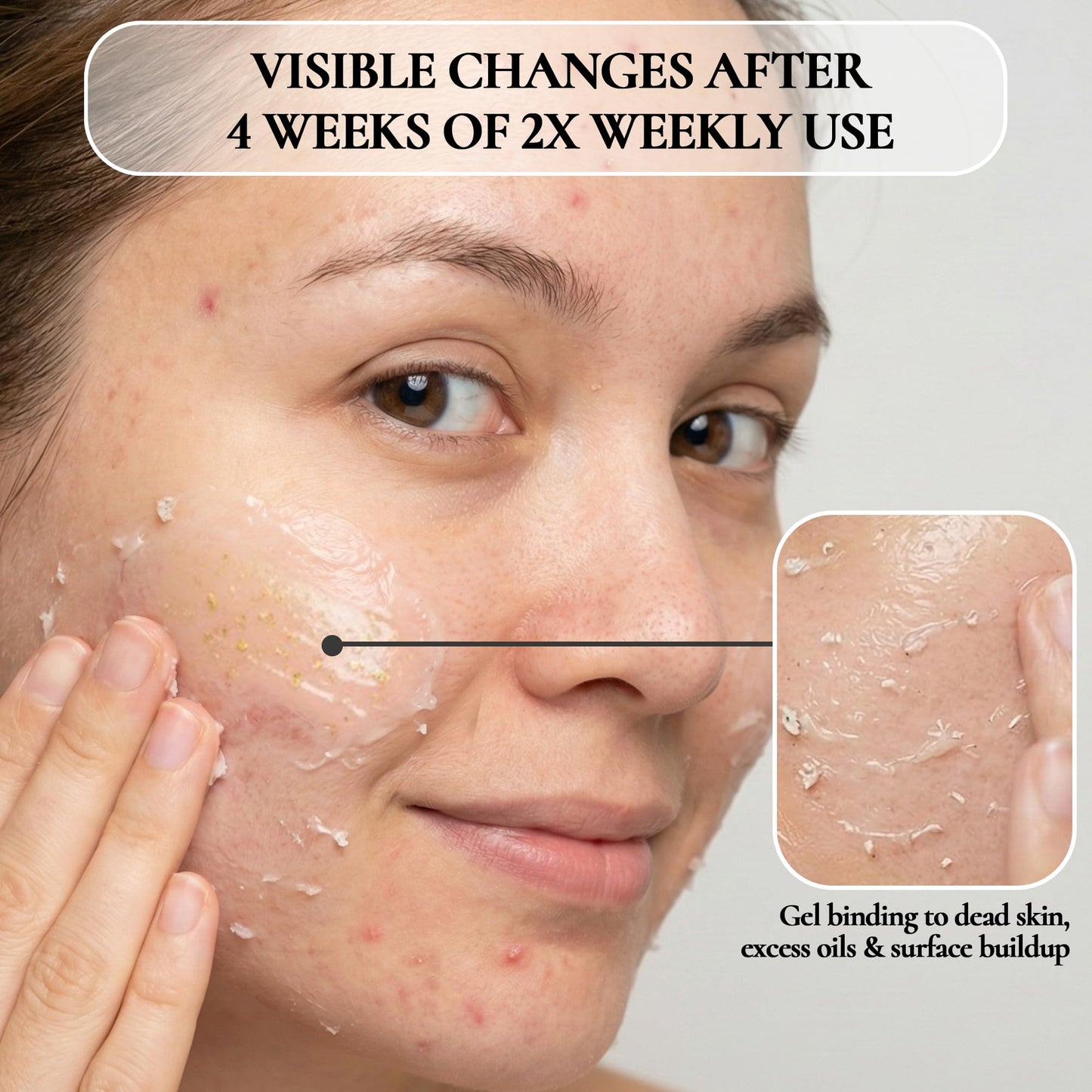 Vivo Per Lei Facial Peeling Gel - Helps Address Dead Skin Buildup - Gentle Exfoliating Gel for Rough, Dry, Sensitive or Mature Skin - Face and Body Scrub - Non Abrasive - 4.05 Fl. Oz. - Pack of 2