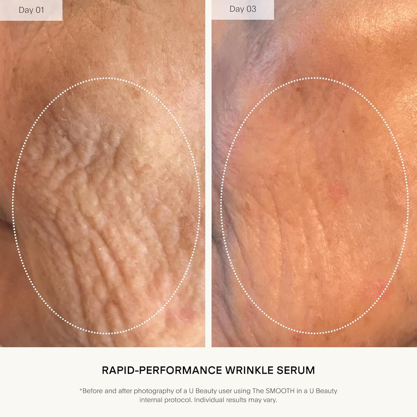 U Beauty The SMOOTH Dynamic Wrinkle Defense Serum - Multi-Peptide Complex for Firming & Hydration | 30ml