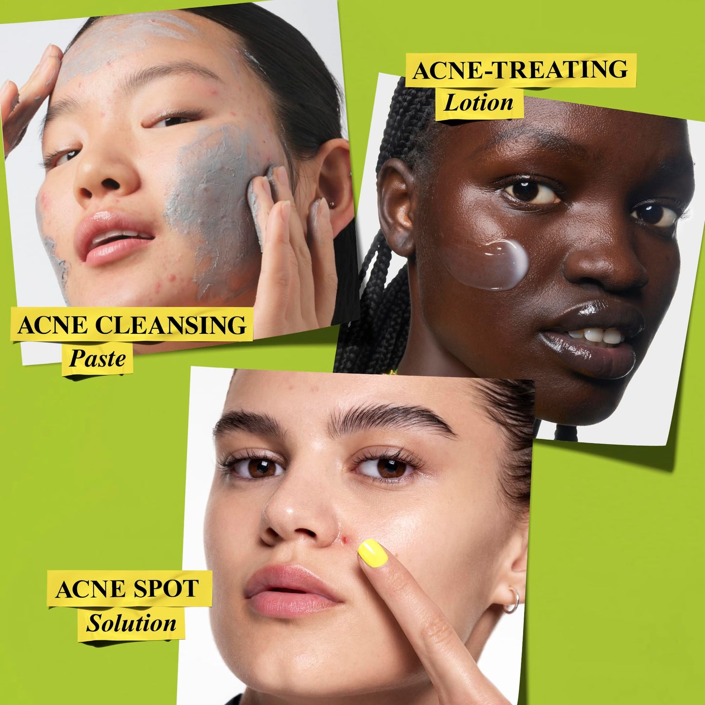 Kiehl's Acne Skincare Routine Gift Set, $98 Value, Includes Face Wash, Pimple Patch, and Facial Cream, Clears Acne, Shrinks Pore Size, Helps Clear Whiteheads and Blackheads, Prevents Breakouts.