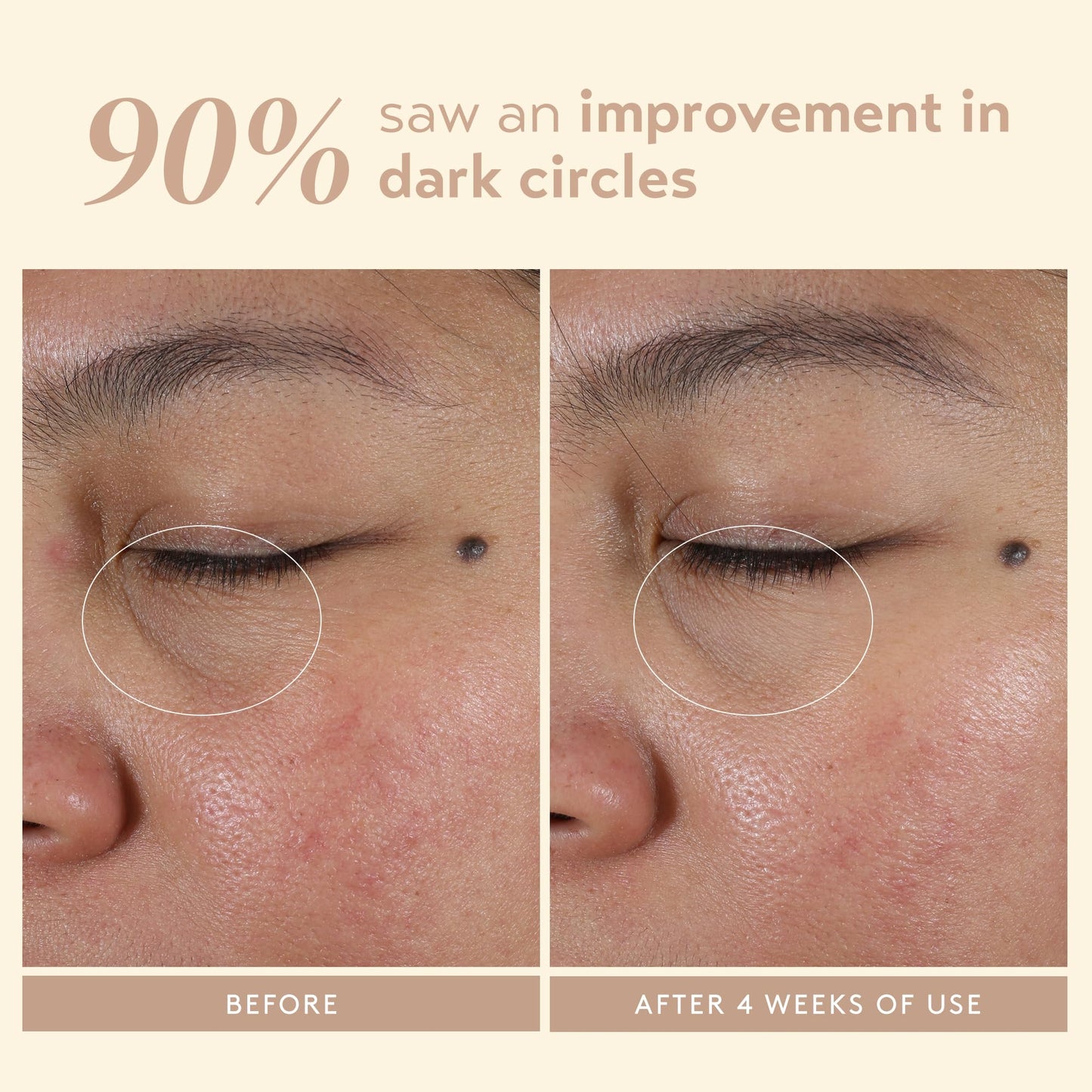 SHANI DARDEN Intensive Eye Renewal Cream, Hydrating Under Eye Cream for Dark Circles, Fine Lines, Wrinkles & Crows Feet with Niacinamide, Shea Butter & Ceramide, Crease-Free & Makeup-Ready, 0.50 fl oz
