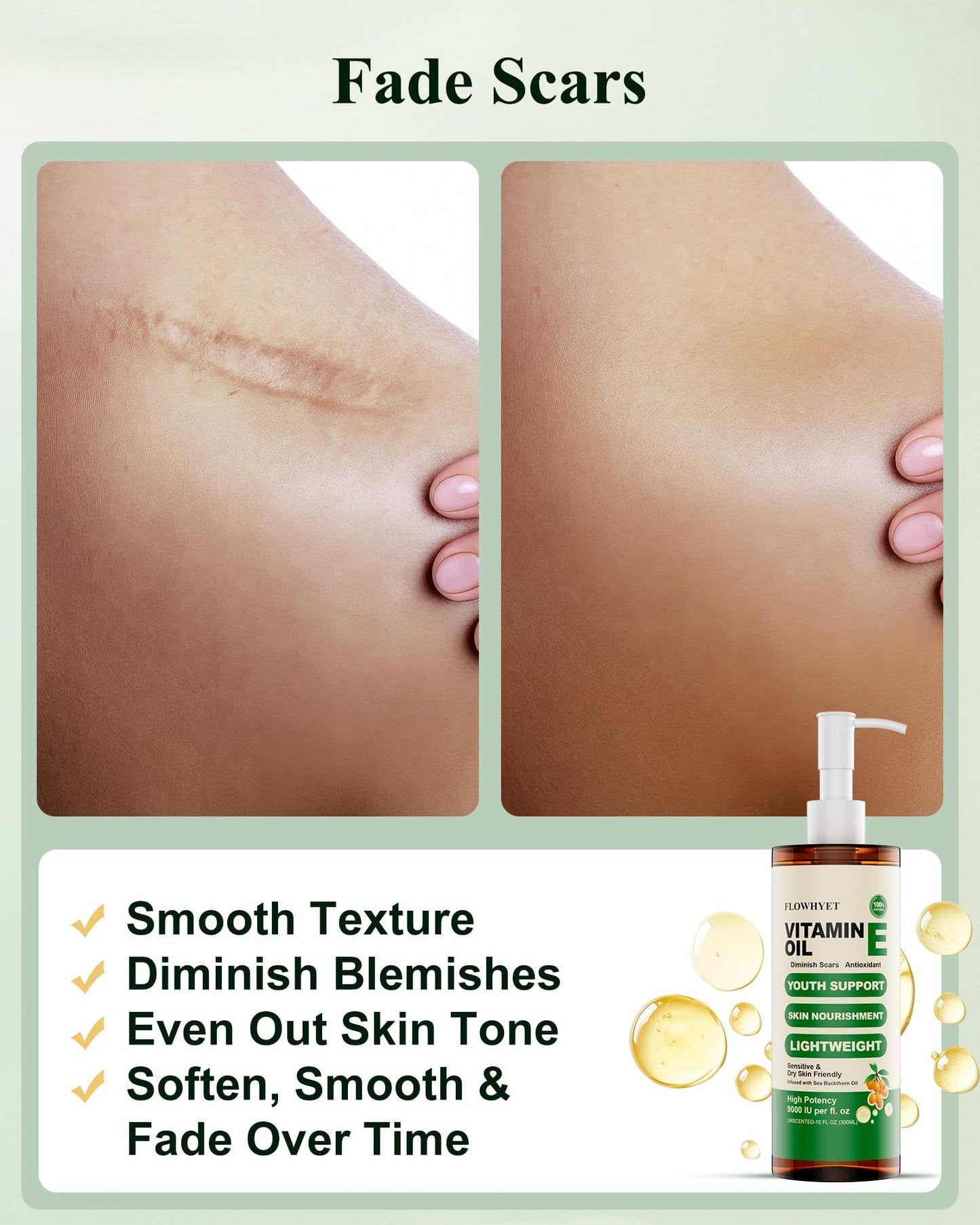 FLOWHYET 5 FLoz Organic Vitamin E Oil for Skin, Pure Vitamin E Oil for Scar, Stretch Marks, vit e for Cuticle, Skin and Hair, Lightweight Unscented Body Oil Moisturizing -150ML