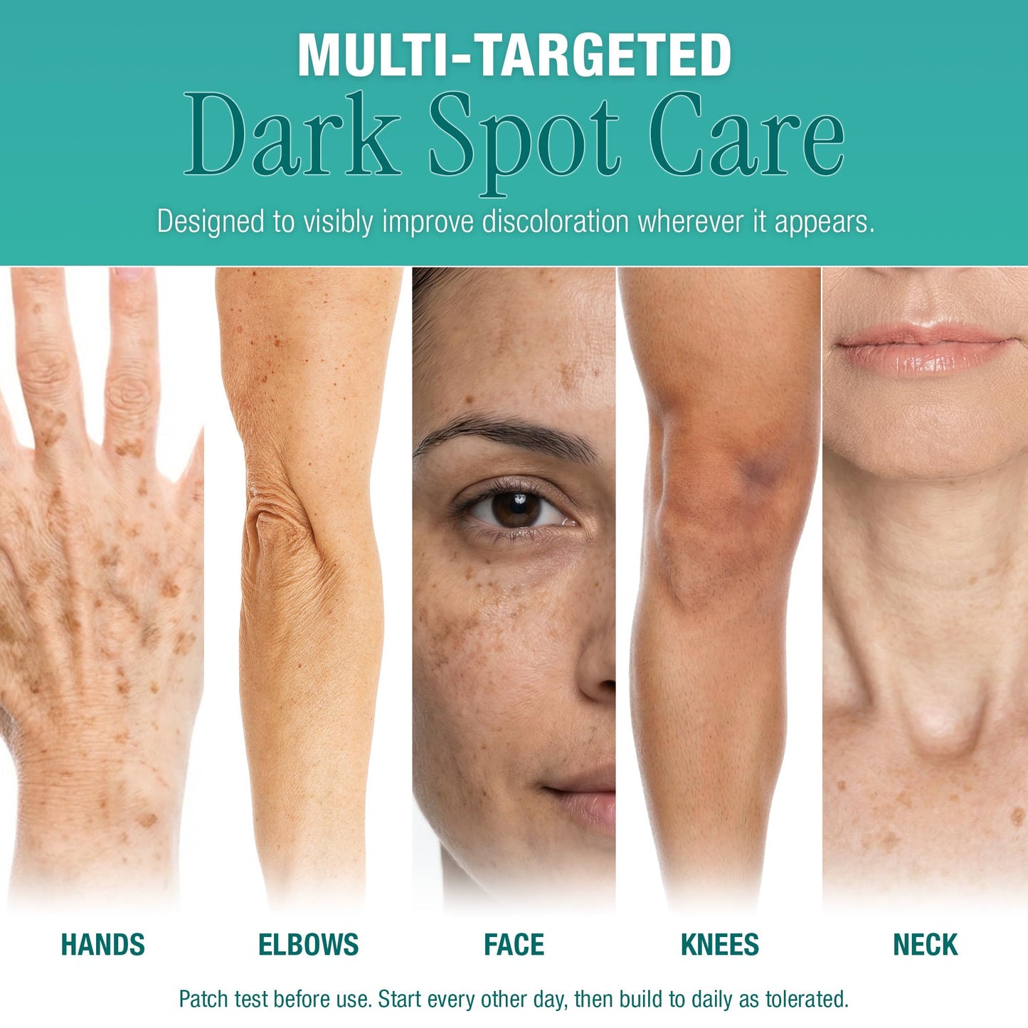 Ebanel Dark Spot Remover for Hyperpigmentation, Melasma and Age Spots