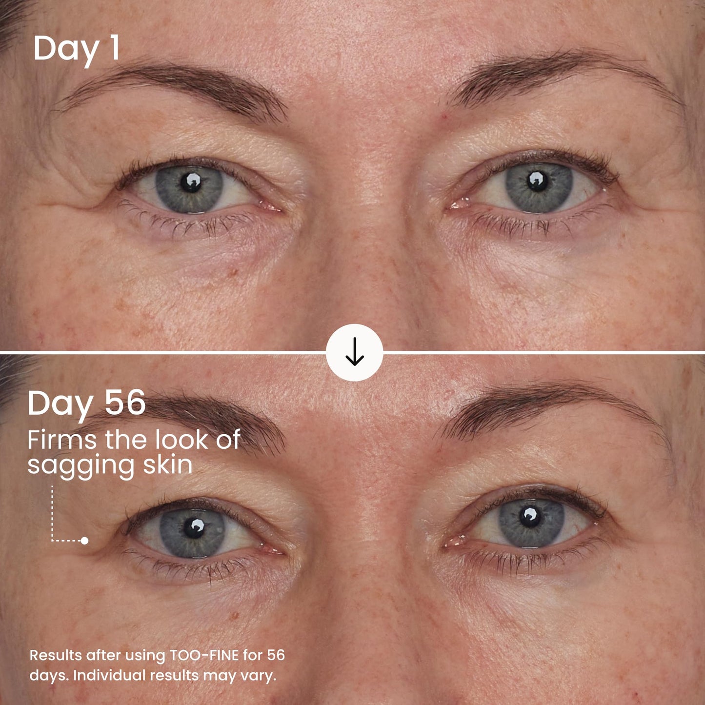 MAËLYS TOO-FINE Firming Anti-Aging Face Serum - Instantly Lifted Look - Glaucine & Bacillus Ferment - Face Tightening Serum Helps Lift Look of Sagging Skin on Jawline, Cheekbones & Under Eyes (15 mL)