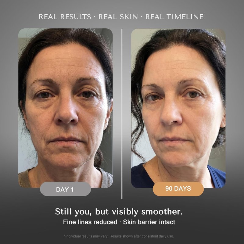 Retinol Serum for Face Wrinkles - Anti-Aging Skin Booster Duo | Moisture-Locking Formula for Eyes & Neck (2 x 30 ml)
