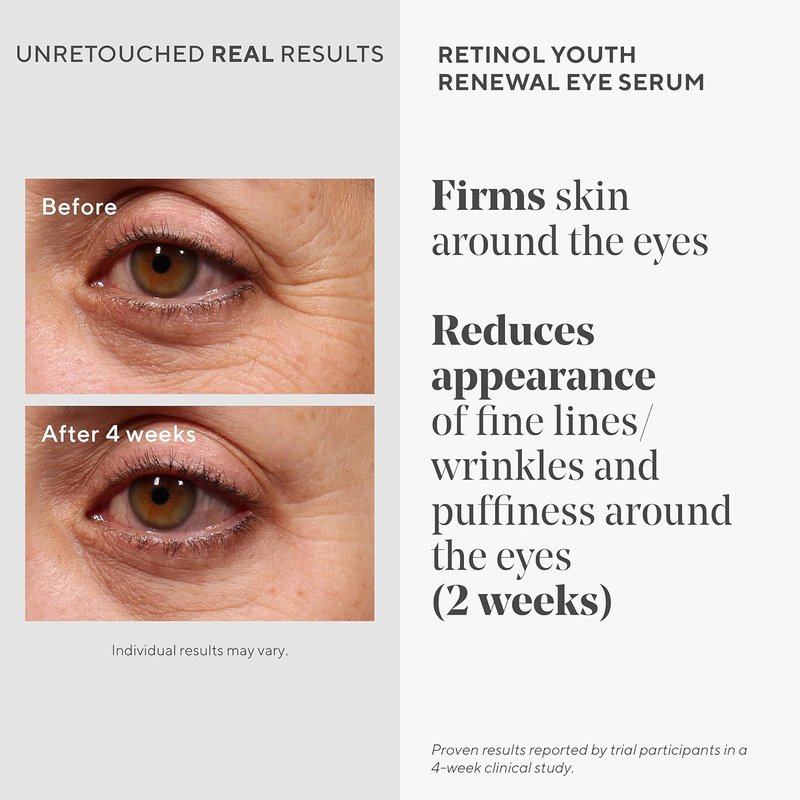 Murad Bright Eyed & Spotless Combo - Retinol Eye & Dark Spot Serums for Discoloration & Fine Lines | Set of 2