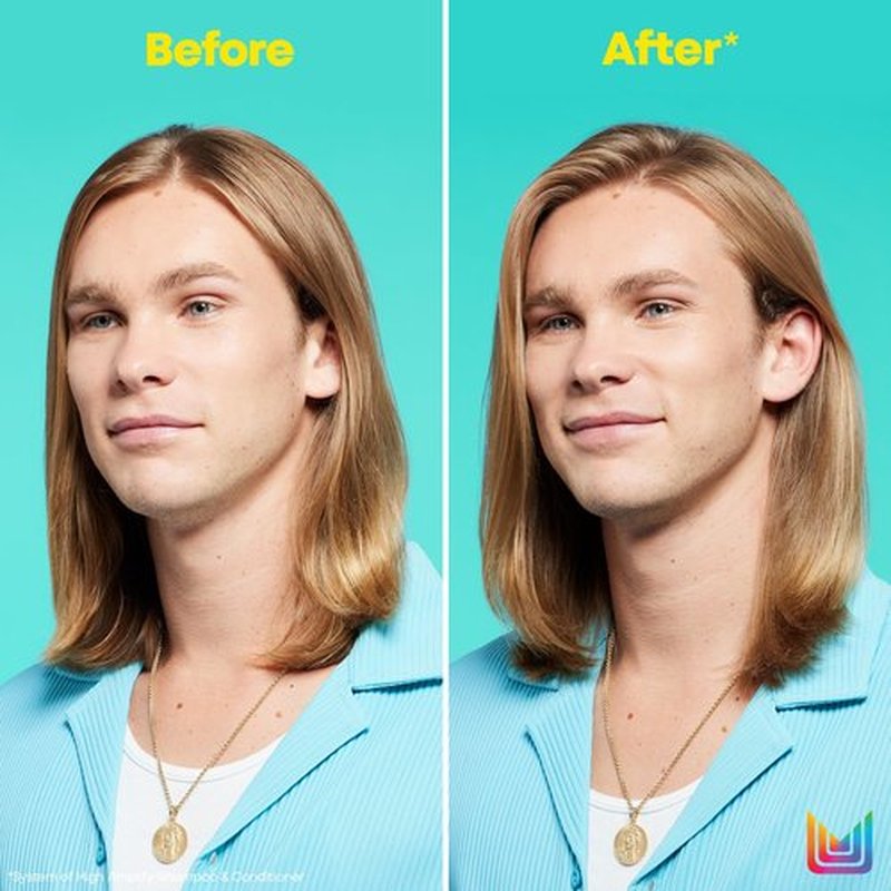 Matrix High Amplify Volumizing Conditioner | Instant Lift, Lasting Volume & Strengthening | Silicone-Free | Boost Structure in Fine, Thin & Limp Hair | Salon Professional Conditioner