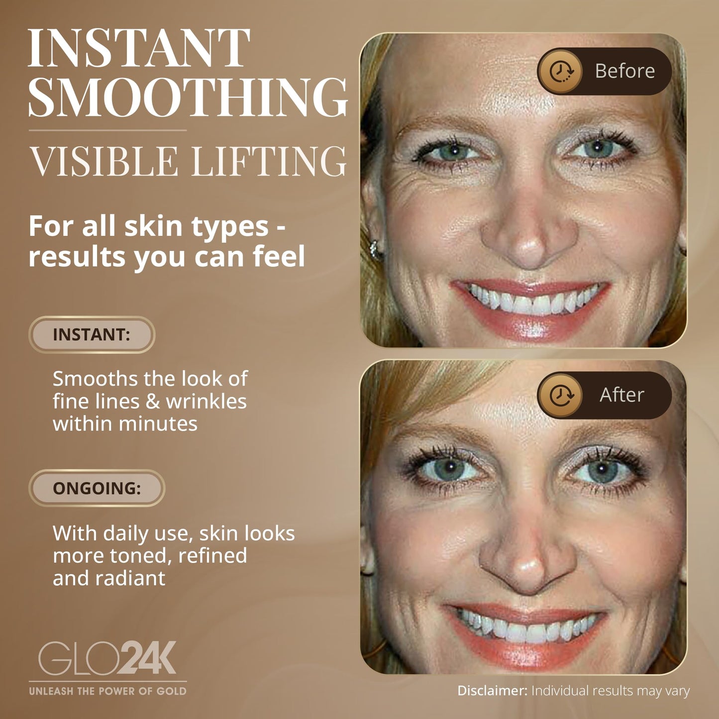 GLO24K Instant Wrinkle Filler for Face, XL Lifting Cream for Eye and Face, Lift and Tightening Non-Invasive with Hyaluronic Acid, 24k Gold, Peptides and Vitamins for Youthful Appearance, 1.2 fl oz