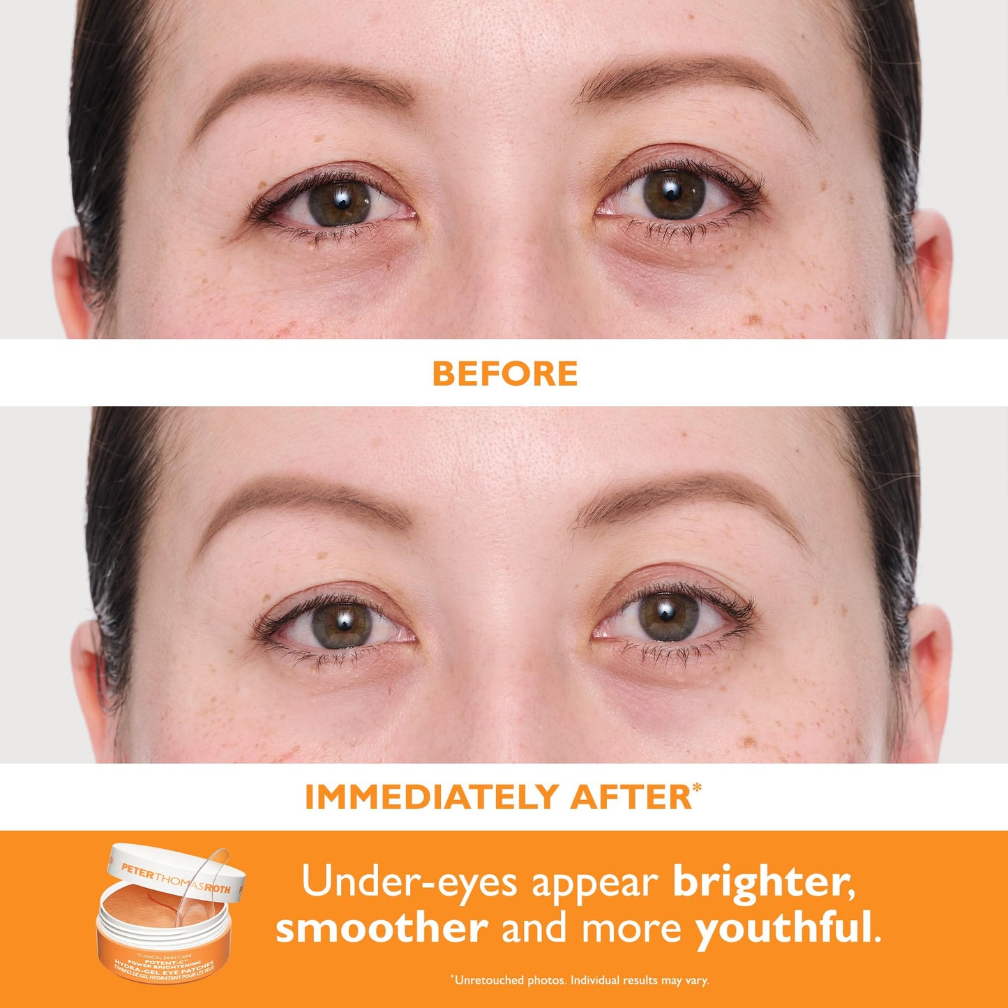 Peter Thomas Roth Women's Full-Size Vitamin C & Hyaluronic Eye Patches 2-Piece Kit