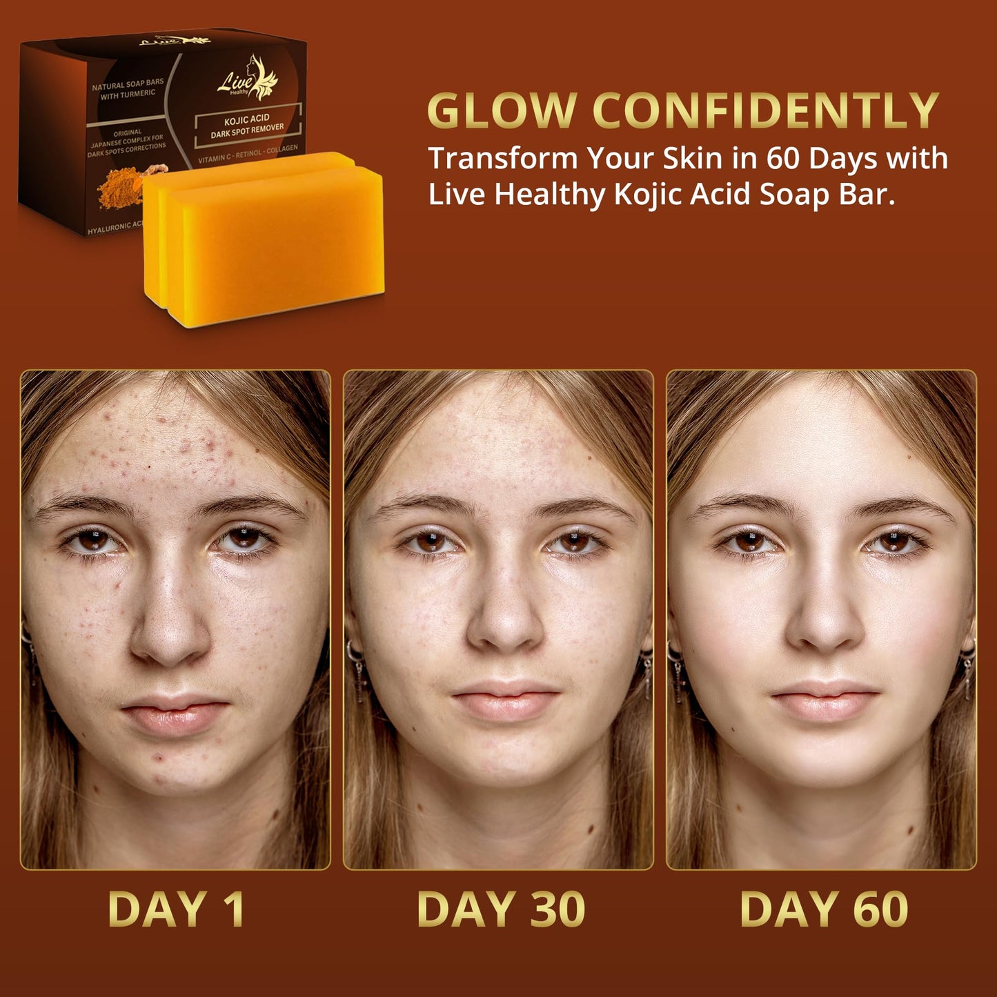 Live Healthy Kojic Acid Soap - Skin Brightening and Lightening for a Radiant Complexion - Natural, Gentle, Turmeric Soap Bar for Dark Spots, Uneven Skin Tone & Acne Scars - 2 Pack + Holder & Net