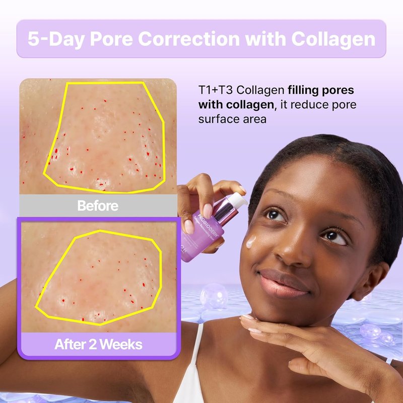 Collagen Remodeling Serum & Gel Mask Set - Firming, Pore-Tightening Skincare with Collagen & Peptides | 6 Hydrogel Masks Included