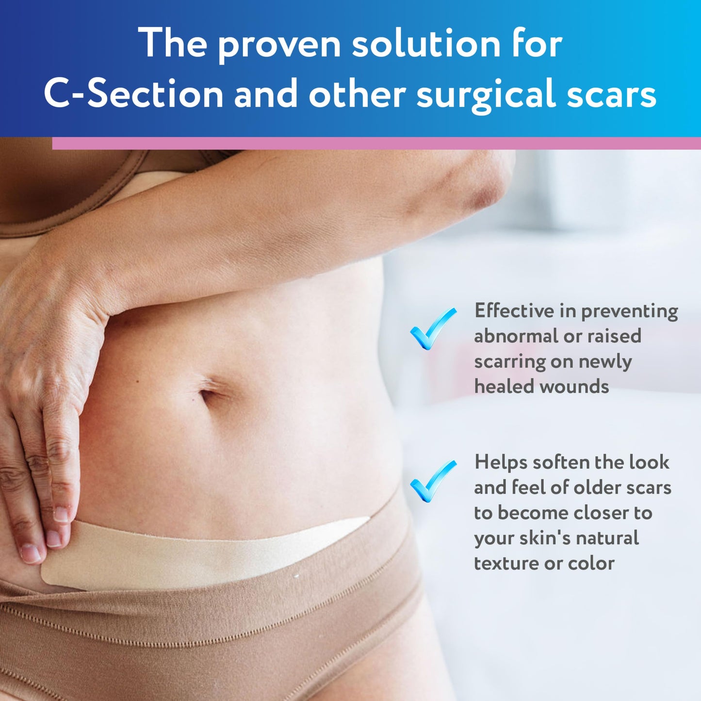 ScarAway Advanced Silicone Scar Sheets for C-Section, Reusable Strips (1.5” x 7”) for Hypertrophic and Keloid Scars from C-Section & Other Surgeries, 4 Sheets