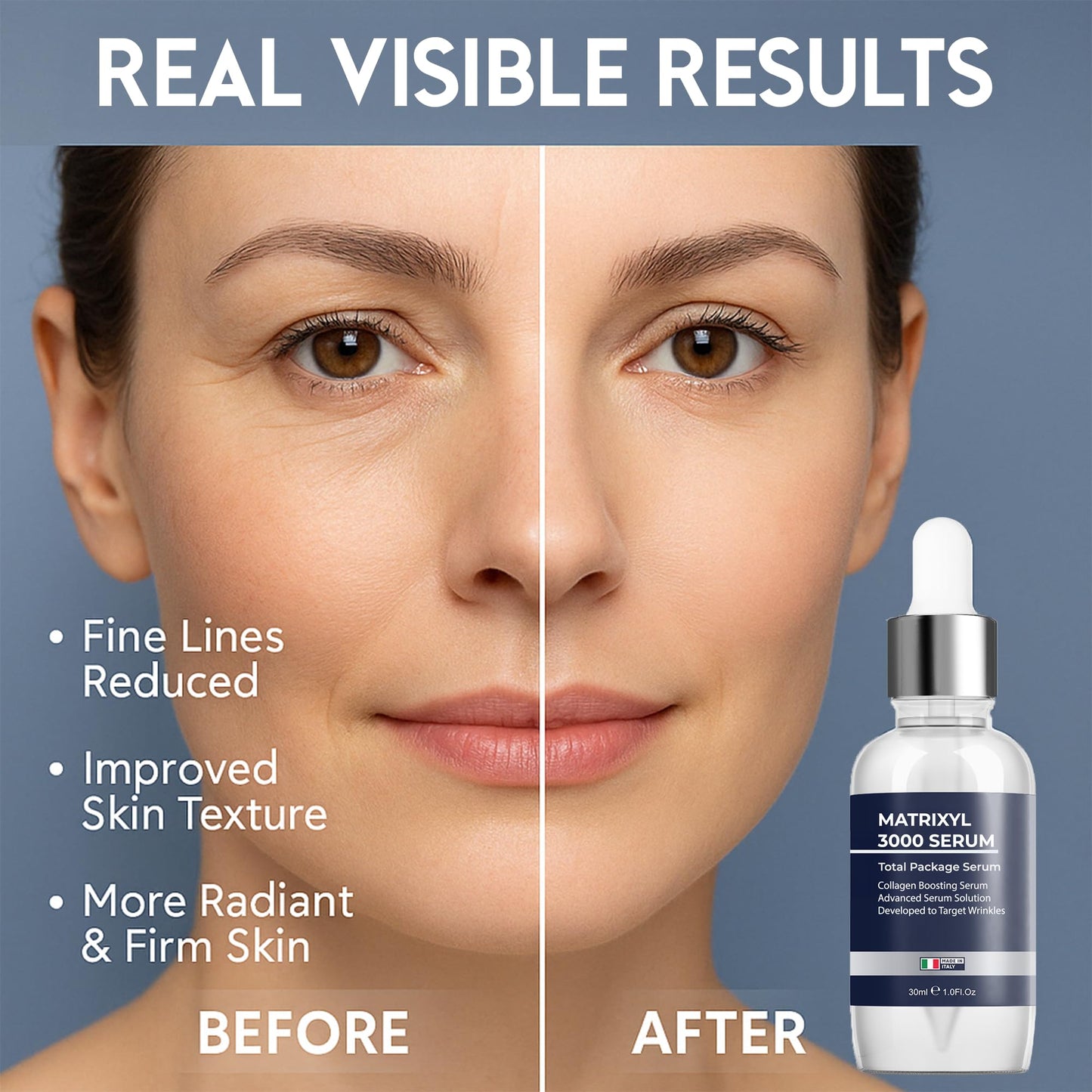 Matrixyl 3000 Total Package Serum with Hyaluronic Acid, Argireline Serum for Anti-Wrinkle, Collagen Boosting, Anti-Aging & face hydrating, Deep Wrinkle Repair & Firming for Fine - 30ml