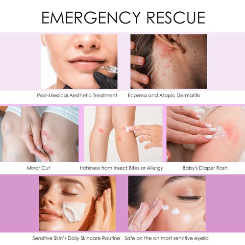 Natural SKIN REPAIR. Clinically tested Aromatherapy. Powerful Essential Oil. Eczema, Dermatitis, Diaper rash, and Sensitive skin. For all skin types. Hypoallergenic, Vegan, Paraben Free. 50ml bottle