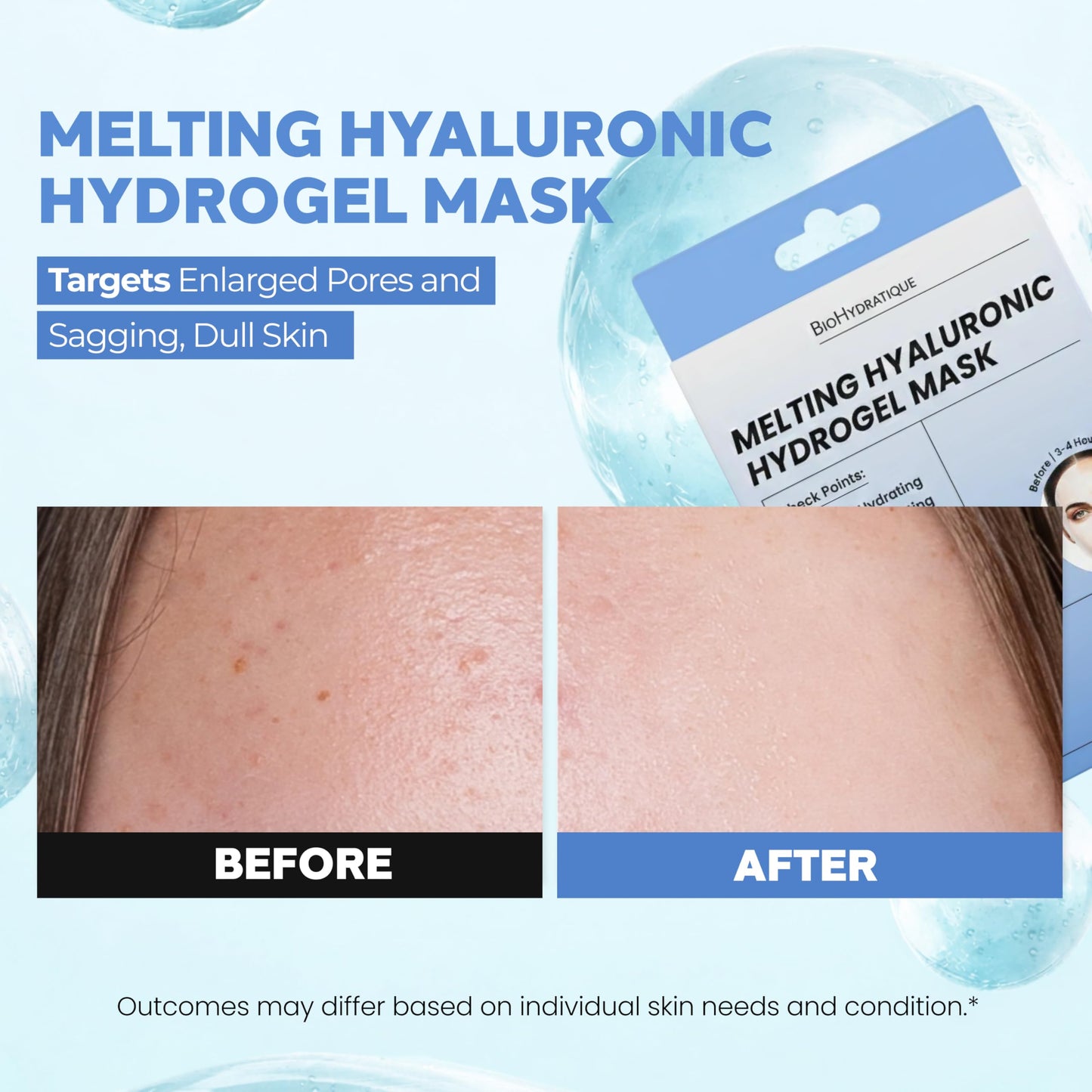 Bio Hydratique Melting Hydrogel Face Mask with Hyaluronic Acid – Deep Hydration & Pore Tightening, Glass Skin Look – Dermatologist Tested, Anti Aging Korean Skin Care, Vegan, Clean Beauty – Pack of 5
