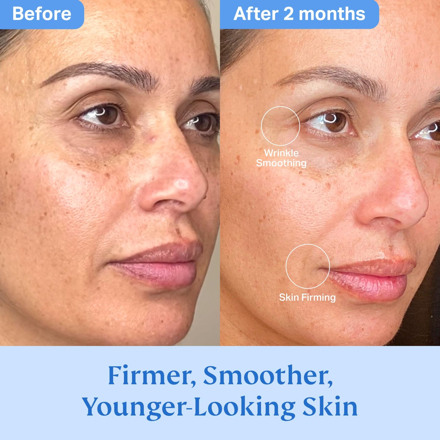 HYDRONOVA Skincare Bundle: Anti-Aging Face & Neck Cream + Total Rewind Sculpting Serum – Skin-Firming, Wrinkle-Reducing Moisturizer & Line-Smoothing Dark Spot Corrector