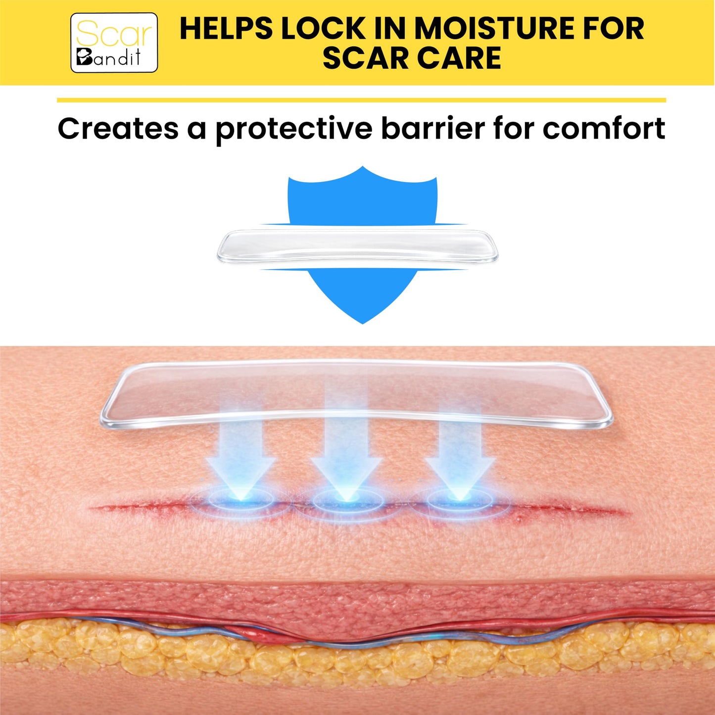Scar Bandit Silicone Scar Sheets for C-Section & Surgical Scars – Silicone Scar Tape for C-Section Recovery After Birth, Tummy Tuck & Surgery – Flexible Scar Sheets for Keloid & Scar Care - 4 pcs