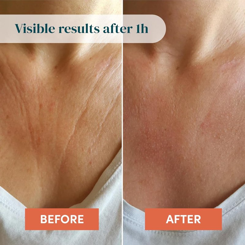 Silicone Chest Wrinkle Pad - Reusable Hyaluronic Acid Anti-Wrinkle Patch | 30x Décolleté Skin Tightening Solution, Made in Germany