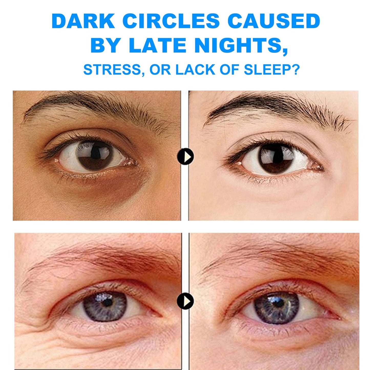 YURHERSU Moisturizing Men's Eye Repair Cream with Aloe & Protein Peptides, Hydrating Under Eye Cream to Reduce Puffiness, Dark Circles, Crows Feet and Bags, Daily Skin Care Treatment Cream, 1.69 oz