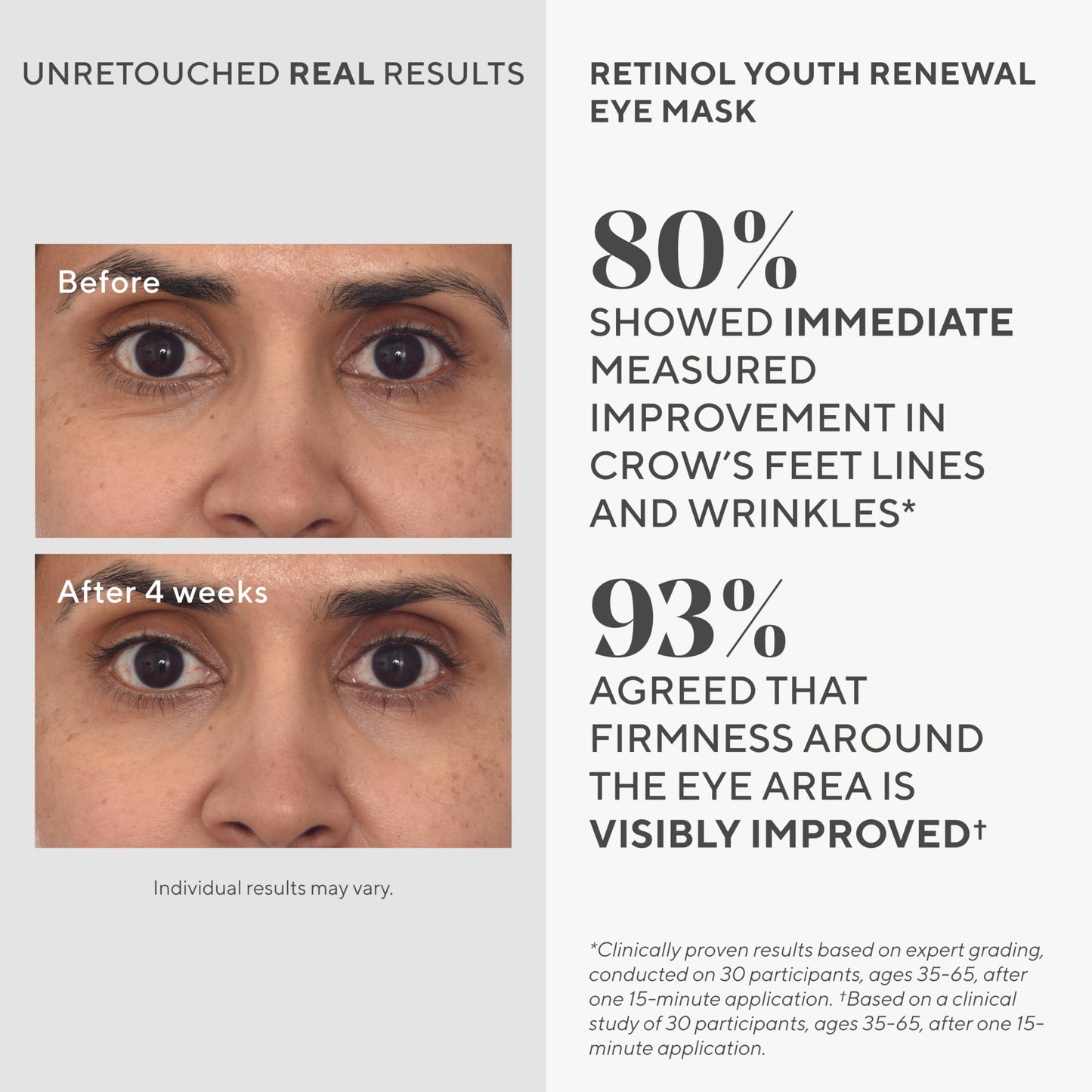 Murad Retinol Youth Renewal Eye Masks – No-Slip Under Eye Patches for Fine Lines, Wrinkles, Crow’s Feet and Puffy Eyes - Full Absorption Treatment Strips, 1 Pair