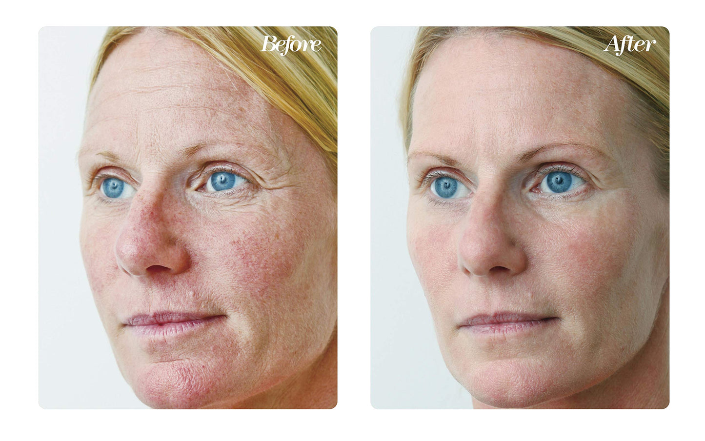 Osmotics Blue Copper 5 Firming Elasticity Repair – Anti-Aging Cream for Wrinkles, Firmness, and Acne. Visible Results Quickly. Made in the USA