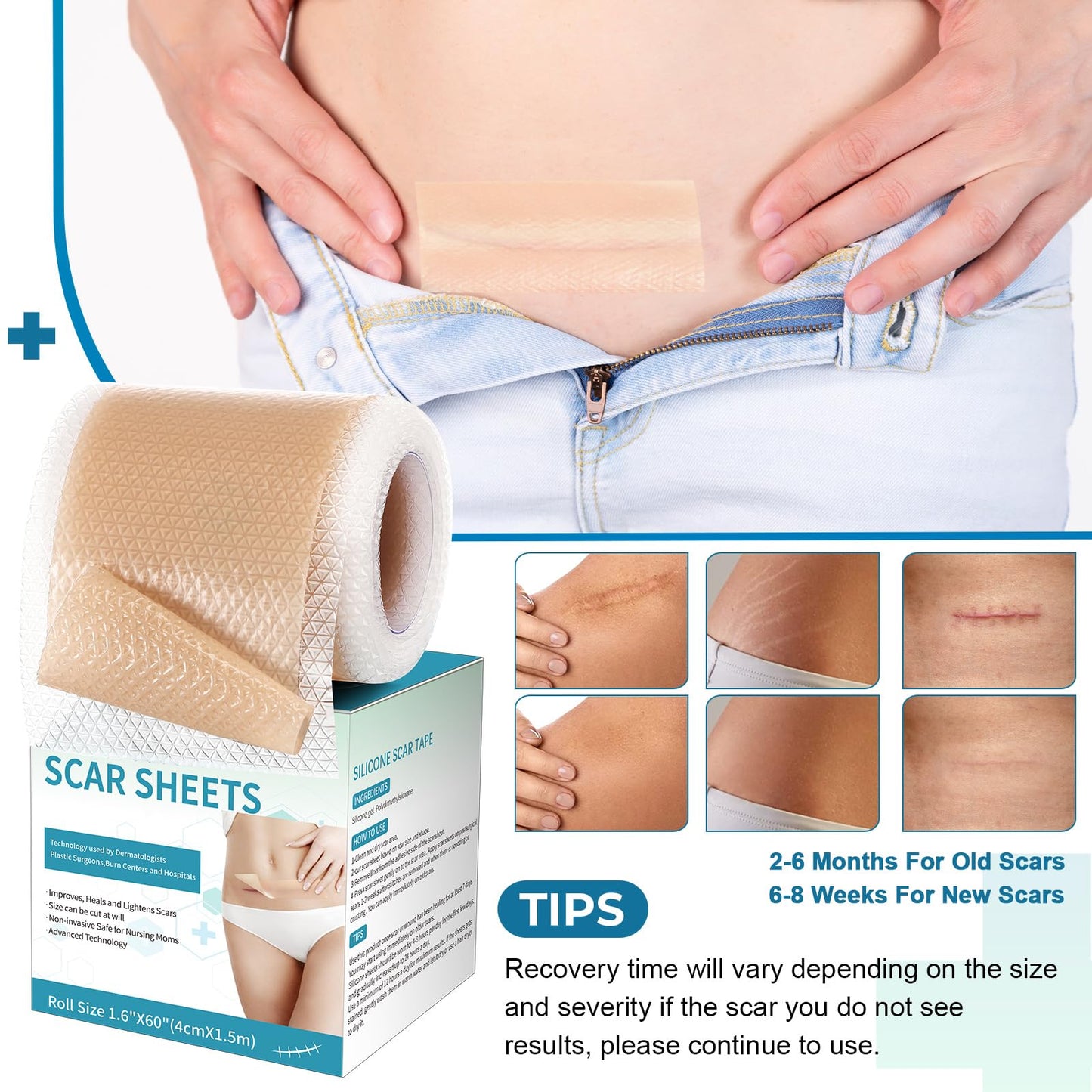 Rvlaim Medical Grade Silicone Scar Sheets (1.6”x 60” Roll-1.5M), Professional Silicone Scar Tape for Surgical C-Section, Keloid, Burn & Acne Scars - Reusable, Waterproof, Stickiness Upgrade