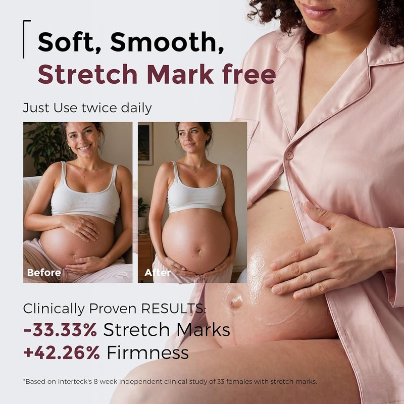 Momcozy Stretch Mark Cream - EWG Verified Pregnancy Moisturizer with 4x Peptides & Centella Oil | 5.29 oz (150g)