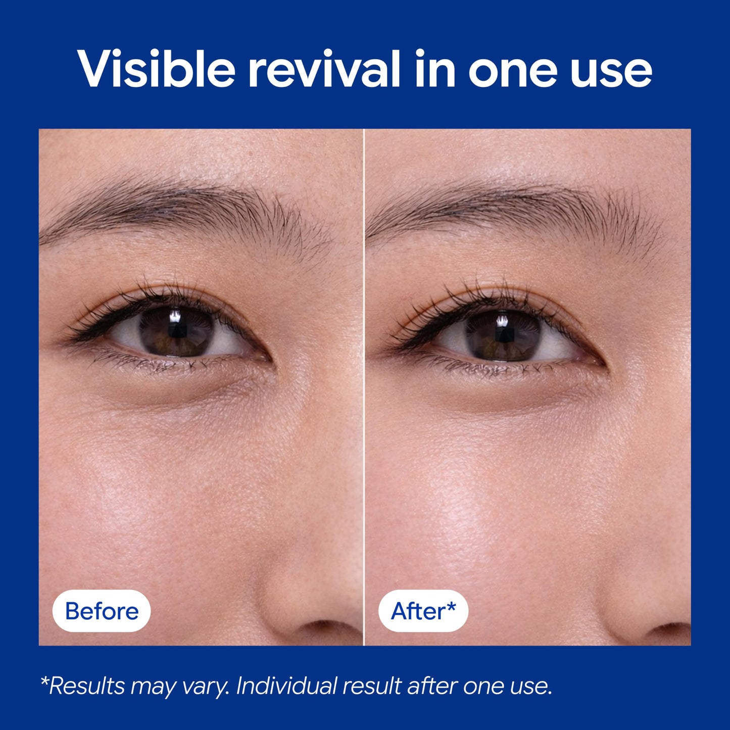 JETLISSE Peptide Eye Patches | Dissolving Microneedle Patches with Tri-Hyaluronic Acid | Anti-Wrinkle Under Eye Treatment for Dark Circles, Firming & Anti-Aging (4 Pairs; 8 Patches)