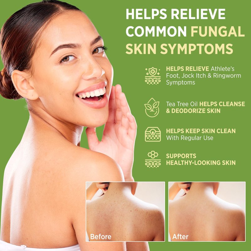 Roycederm Antifungal Bar Soap - Tea tree Oil Soap - Athlete’s Foot Treatment for Jock Itch & Ringworm - Tea Tree Oil Scent, 4 Pack