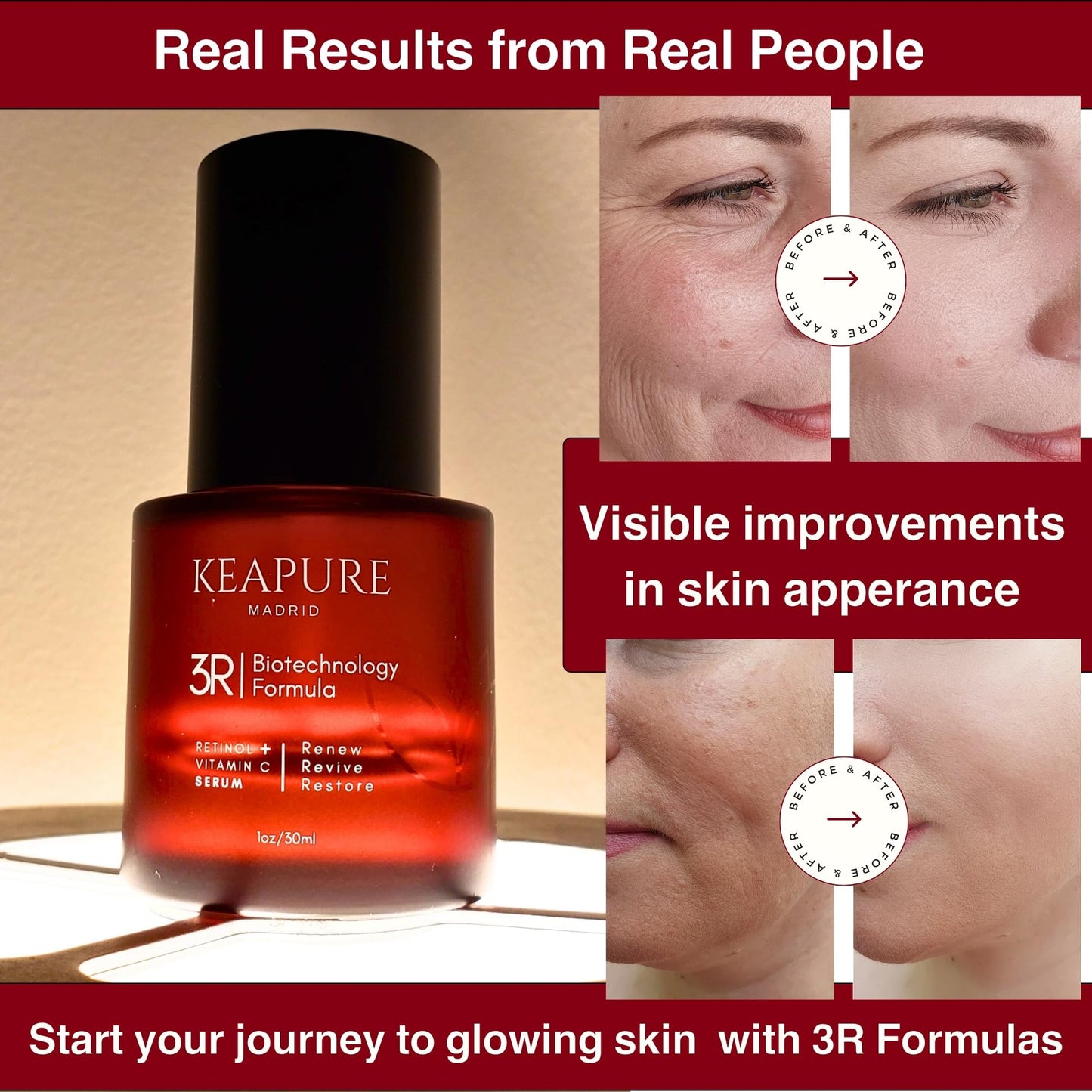 Keapure 3R Revitalizing Serum with Retinol & Vitamin C for Sensitive Skin – Hydrating, Firming, Non-Irritating Formula, 30ml