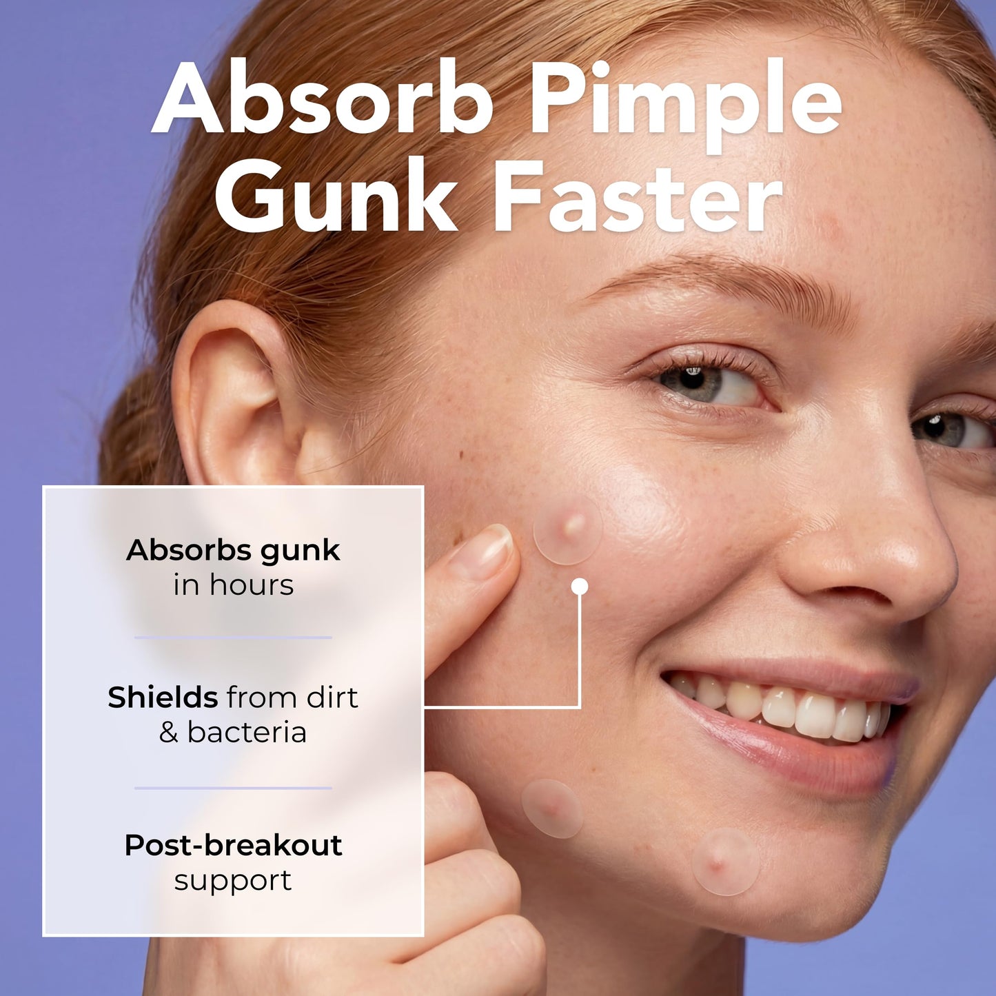 Pimple Patches with Retinol (120 Patches), Hydrocolloid Acne Patches with Tea Tree Oil for Face, Pimple Patch Pimple Stickers - Hydrocolloid Patch Acne Dots - Acne Pimple Patches For Face