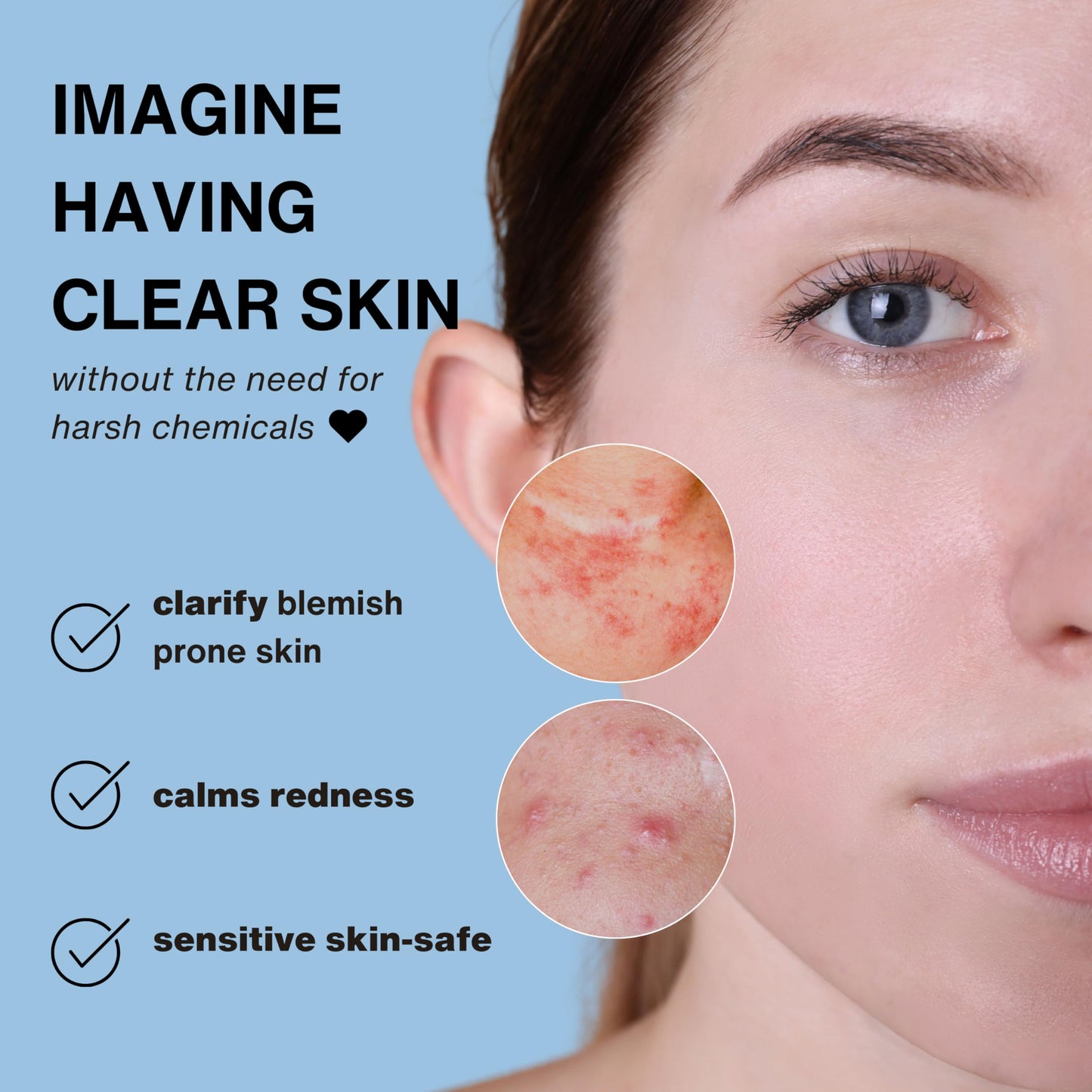 Vital Liquid Hypochlorous Acid Spray – 3.4oz Travel Size HOCl Facial Mist & Daily Cleanser for Sensitive Skin | Clarifying & Calming Toner for Redness, Irritation & Breakout-Prone Skin