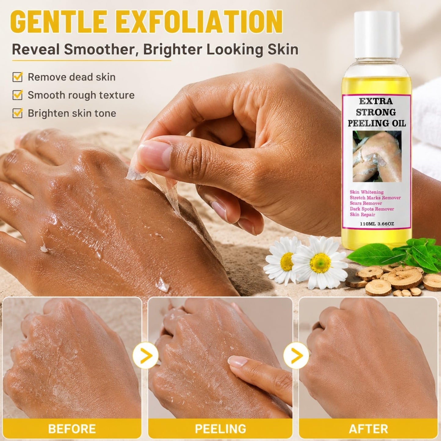 Yellow Peeling Oil for Dark Skin, Extra Strong Peeling Oil, Natural Formula Exfoliating Peels Solution for Face, Body, Hands and Foot Dead Skin Remover (220ML/7.76 OZ)