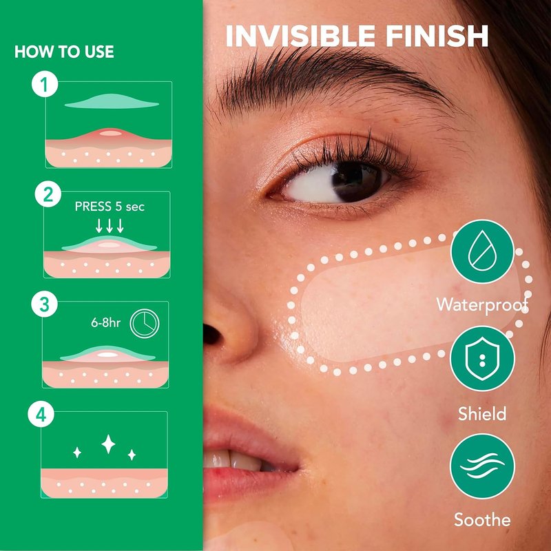 SoloVegan Blemish Patch - Invisible Hydrocolloid Acne Treatment for Breakouts | 55 Count (1 Pack)