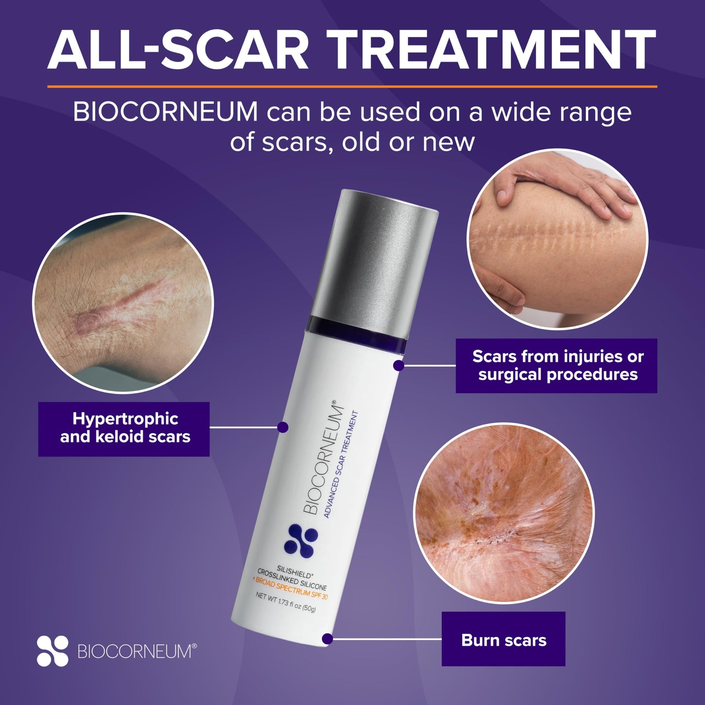 Biocorneum Advanced Scar Treatment – Silicone Scar Gel with SPF 30 & Silishield® 20g – Scar Cream for Surgical Scars, C-Section & Acne – Fast Drying, Water Resistant Scar Removal Gel for Children