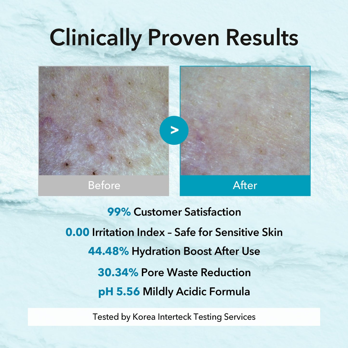 MY BLUE DAYS Hyaluronic Aquaporin Pack Cleanser, Hydrating Gentle Face Wash for Dry & Sensitive Skin, Korean Skincare, 5.07 fl oz / 150 ml