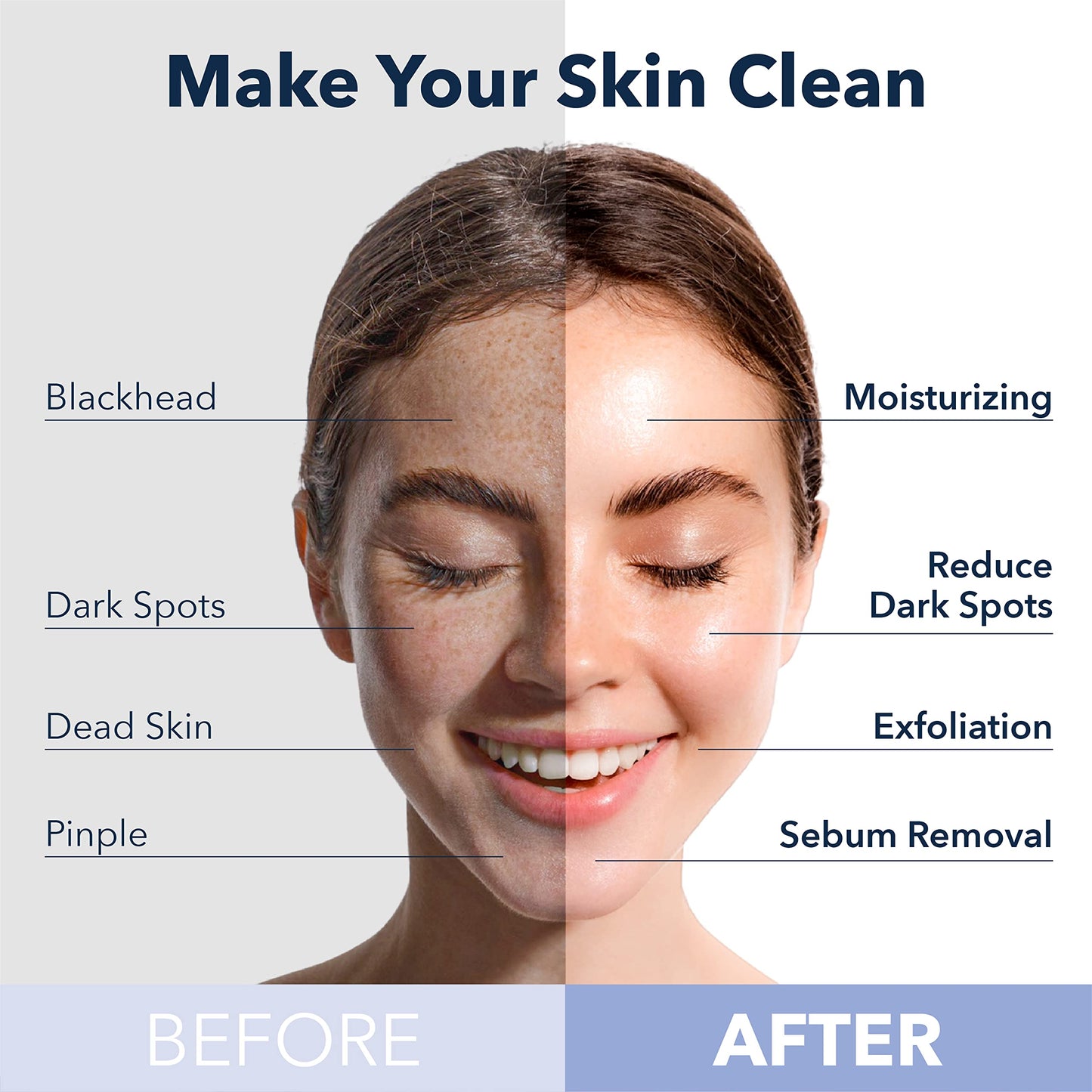 Purederm Peach Bubble Face Mask, Deep Cleansing for Radiance and Healthy Glow, Korean Skincare for Dull Skin (5 Pack)