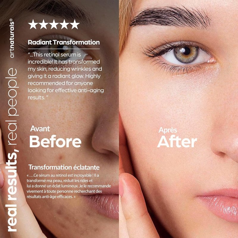 Retinol Serum for Face - Anti-Aging & Skin Repair with Vitamin C & Hyaluronic Acid | Night Therapy (1 Fl Oz / 30ml)