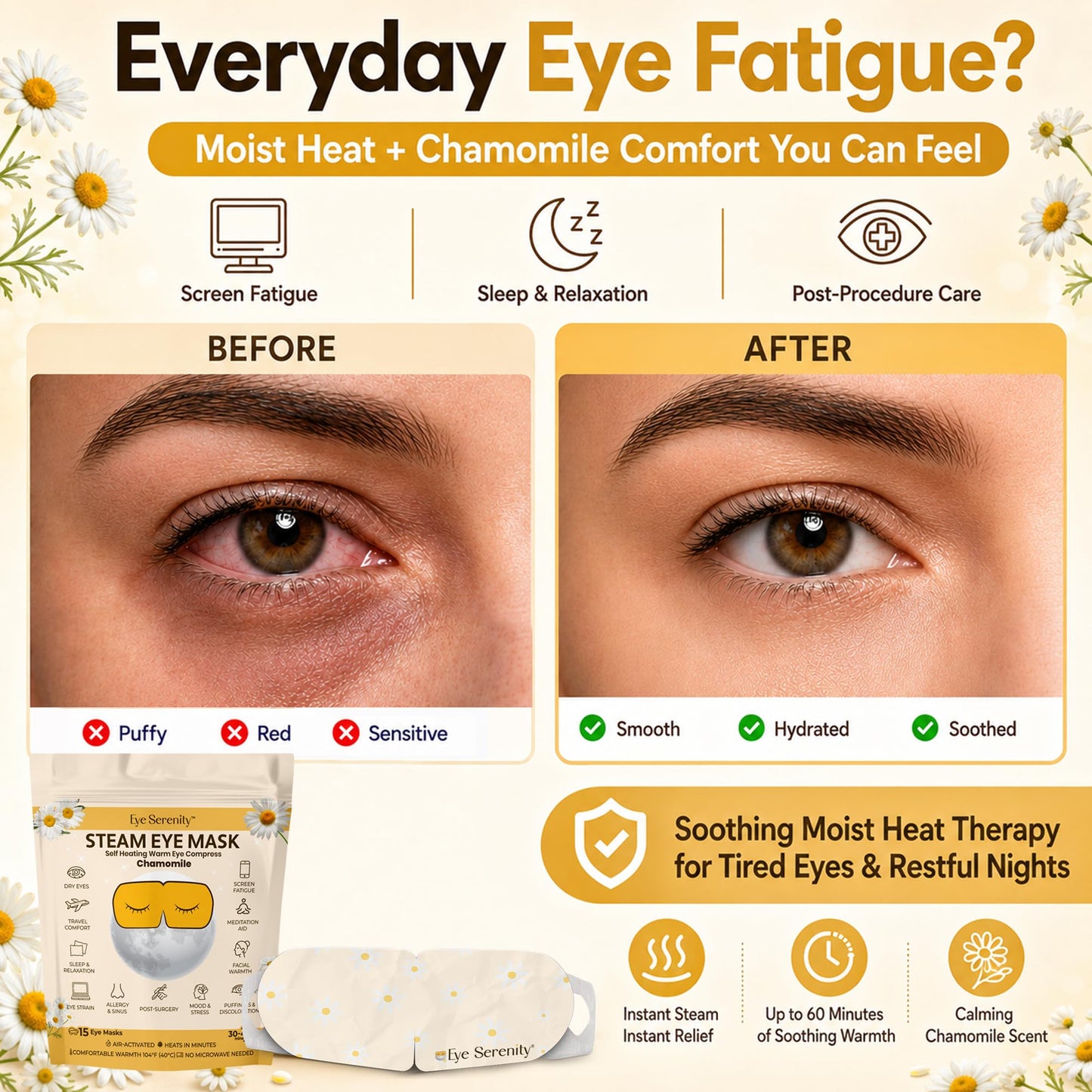 LURE Steam Eye Mask, Heated Eye Mask, Self Heating Warm Compress for Dry Eyes, Fast Relief for Stye, Puffy Sensitive Eyes, Moist Heat, Relaxation Gifts for Women and Men - Chamomile