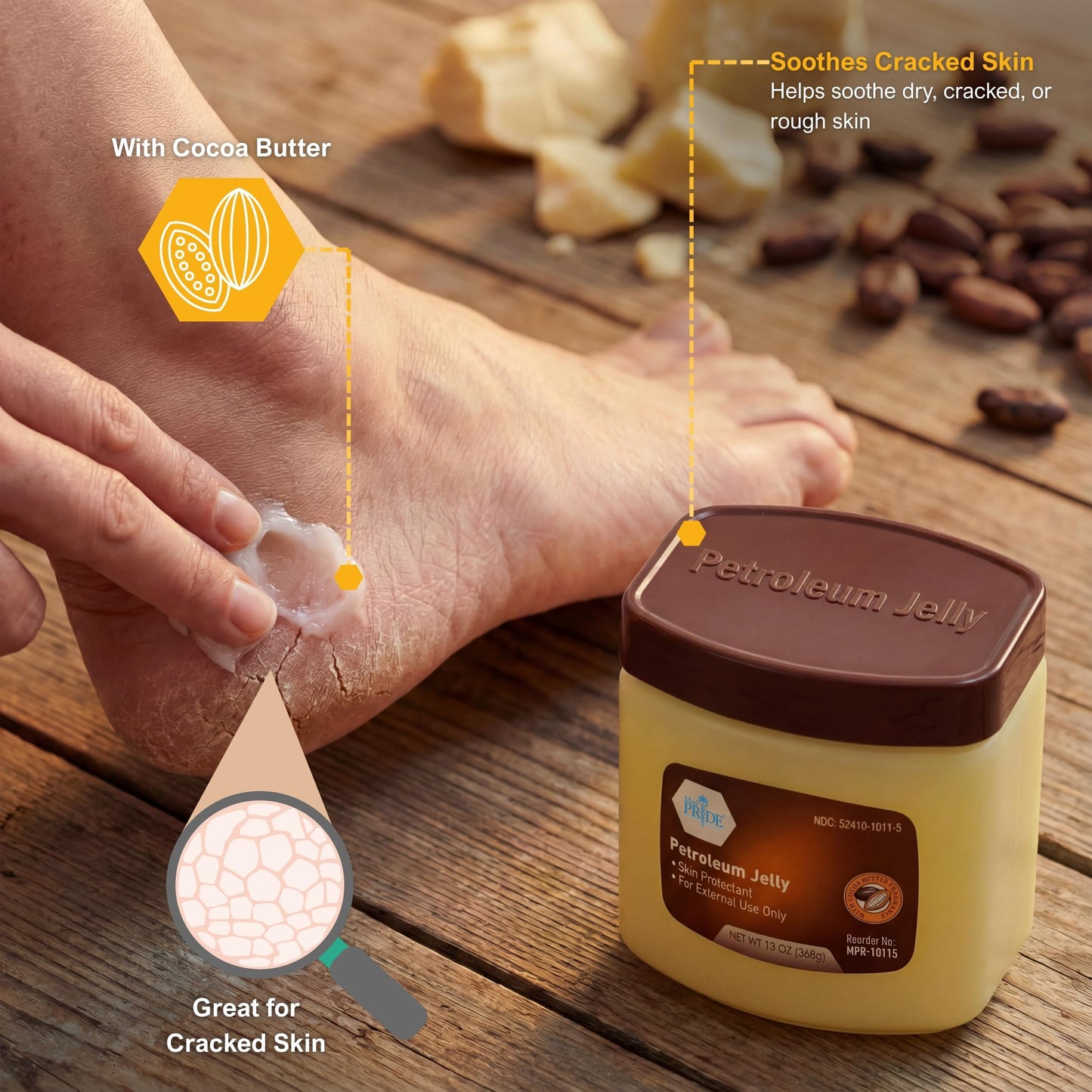 MED PRIDE Cocoa Butter Petroleum Jelly, 13 oz - Moisturizing Skin Protectant for Dry Skin, Cracked Hands, Chapped Lips, Rough Heels & Minor Cuts - Hypoallergenic Cocoa Scented Ointment