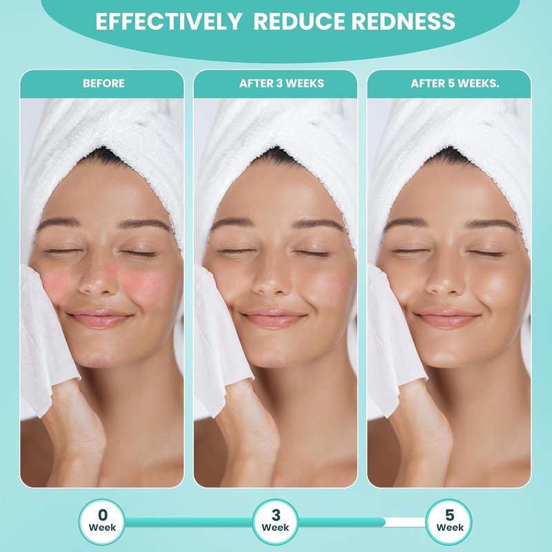 Disposable Face Towels - Ultra-Soft & Thick Travel Wipes for Sensitive Skin | 10"×12" | 15 Towels per Pack