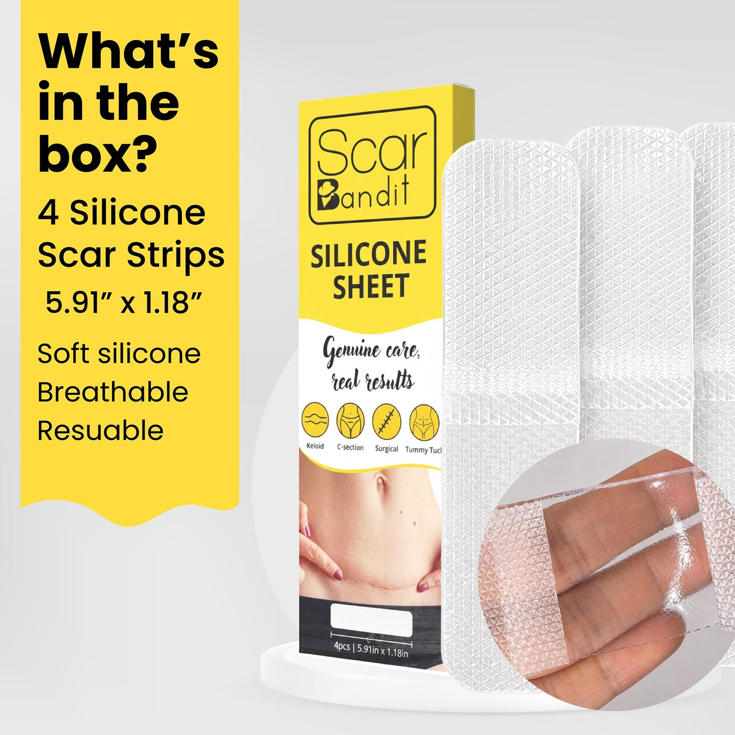Scar Bandit Silicone Scar Sheets for C-Section & Surgical Scars – Silicone Scar Tape for C-Section Recovery After Birth, Tummy Tuck & Surgery – Flexible Scar Sheets for Keloid & Scar Care - 4 pcs
