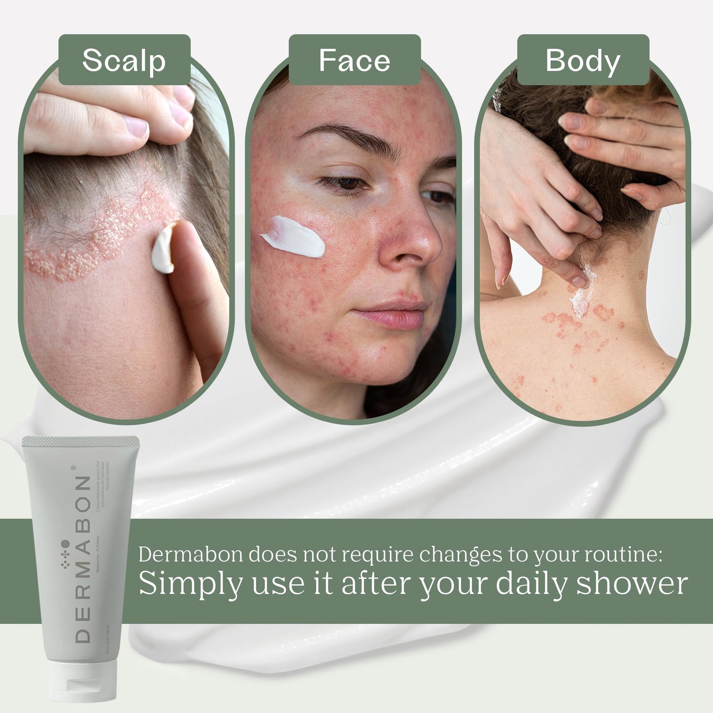 Dermabon Seborrheic Dermatitis Cream, Eczema & Psoriasis Treatment - Calendula Extract, Salicylic Acid, Bee Wax - Soothes, Hydrates & Balances Skin Tone - Moisturizing & Skin Relaxing Relief