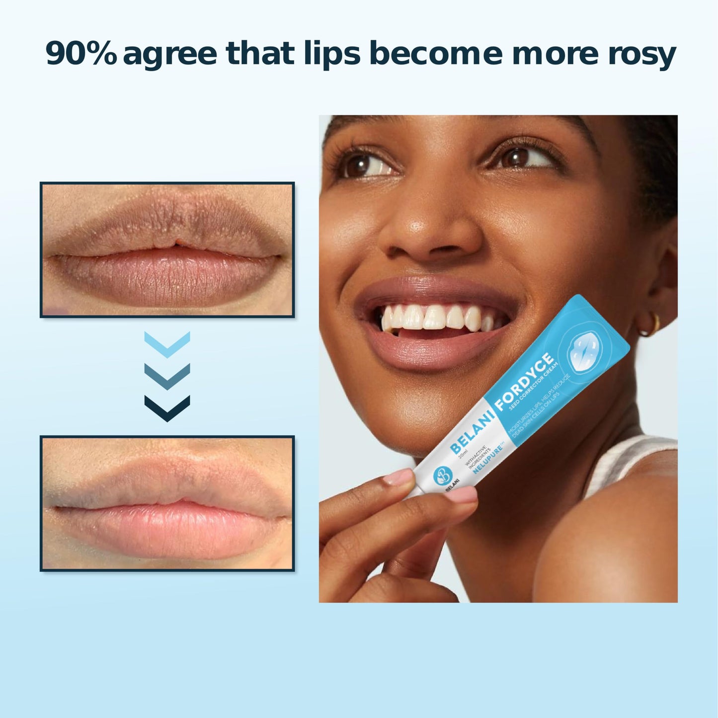 Belani Fordyce Cream - Helps Reduce Fordyce Spots, Daily Hydrating Lip Care for Dry, Chapped & Dark Sensitive Lips with Sunflower Oil, Lotus Extract & Shea Butter (0.7 Oz)
