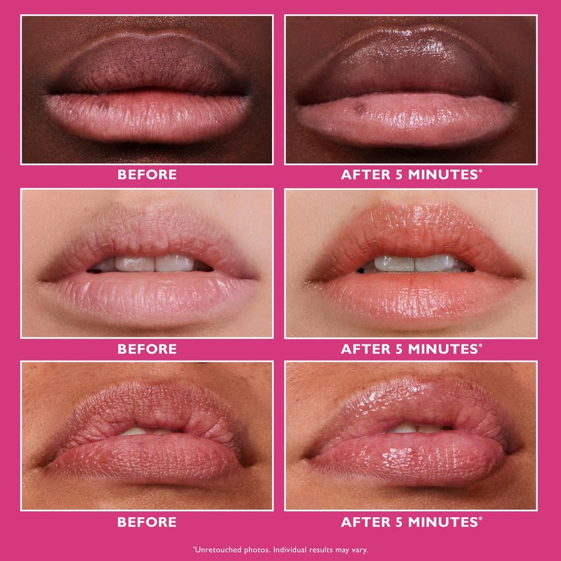 Peter Thomas Roth | Instant FIRMx® Lip Filler, Plumping Lip Treatment, Enhances Volume, Clinically Proven to Immediately Improve the Look of Lip Plumpness and Lip Lines