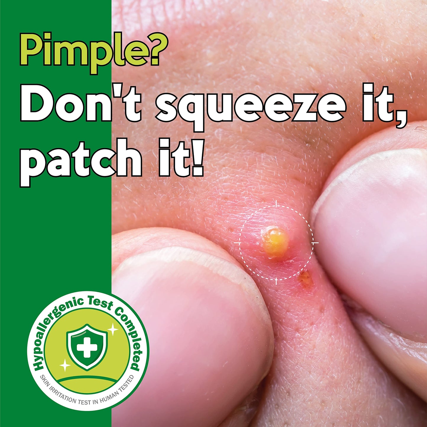 Troubless Micro-Point Pimple Patch - Korean Clear Pimple patched for Face/Micro Needle Pimple Patch with TeaTree Oil/Trouble Care Invisible Patch/Korean Skincare 9 Patches(Pack of 1)