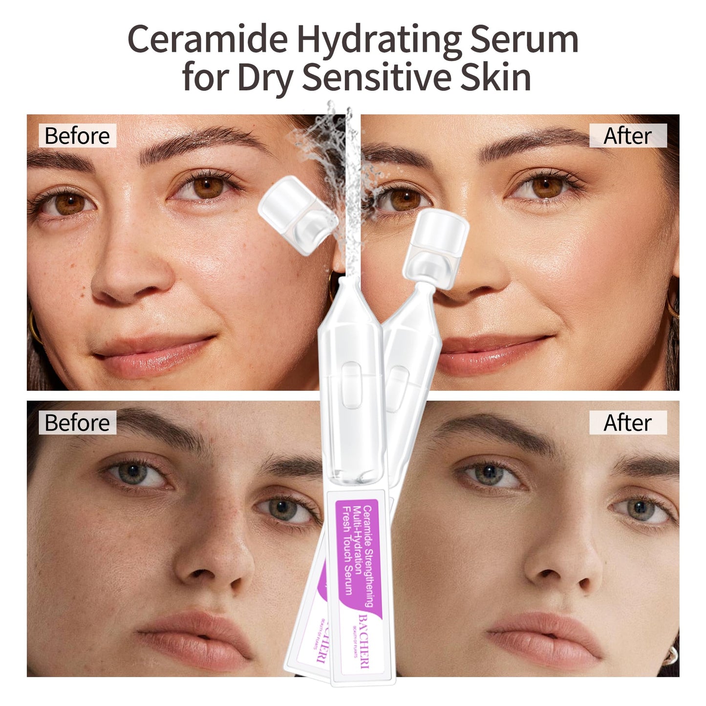 Ceramide Serum for Dry Sensitive Skin – Ceramide Complex with Hyaluronic Acid, Hydrates & Repairs Skin Barrier, Soothes Redness & Irritation, 1.8ml x 30 Ampoules